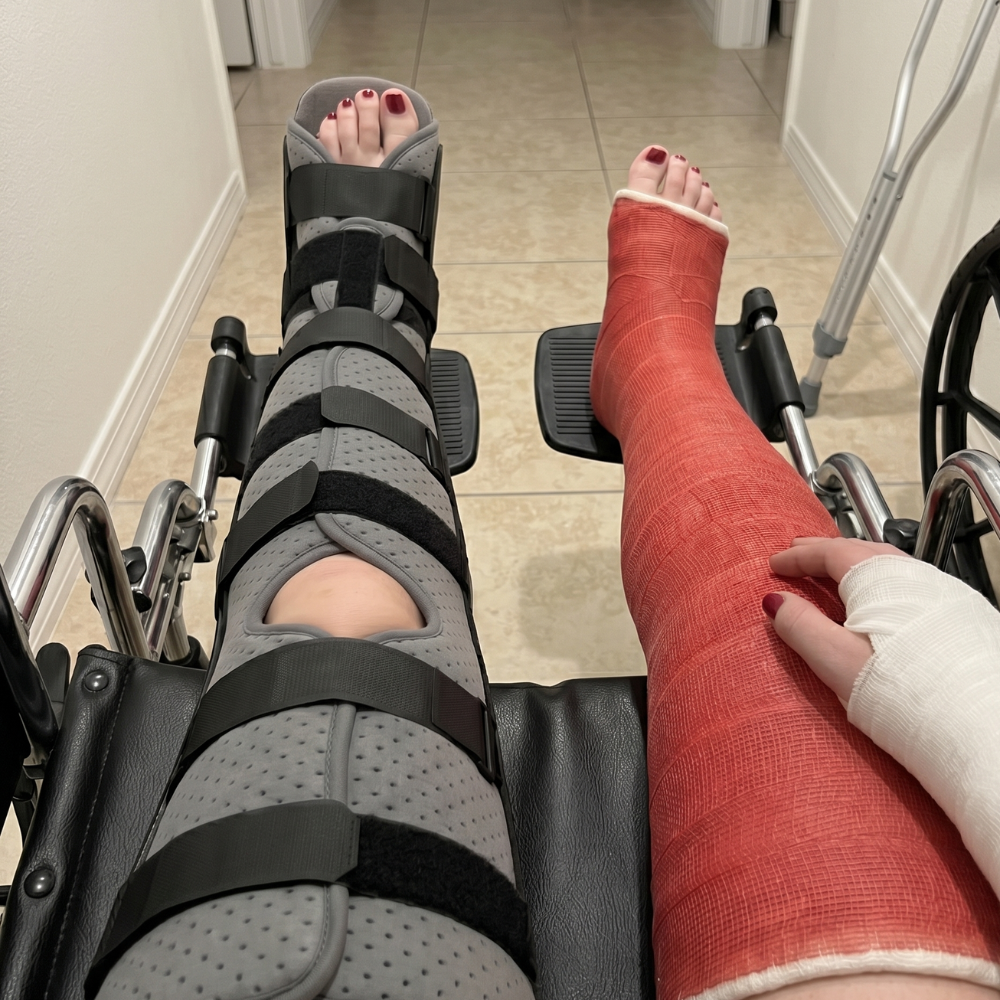 The LLC Brace, Full Leg Immobilizer for Cast Fetish